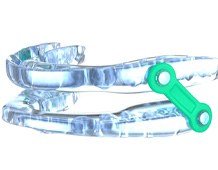 an example of oral appliances for obstructive sleep apnea